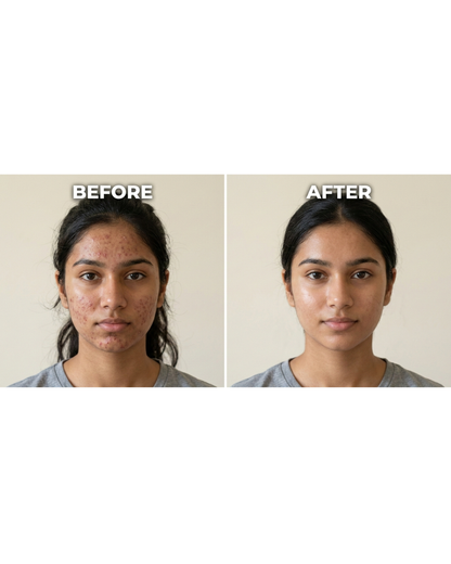 Salicylic Acid 2% Gel Cleanser