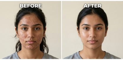 Salisylic Acid 2% Serum